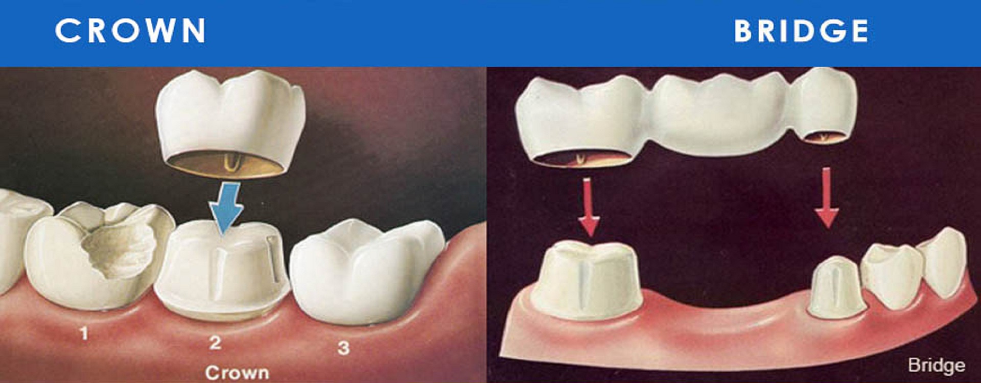 dental treatment in vibhuti khand lucknow