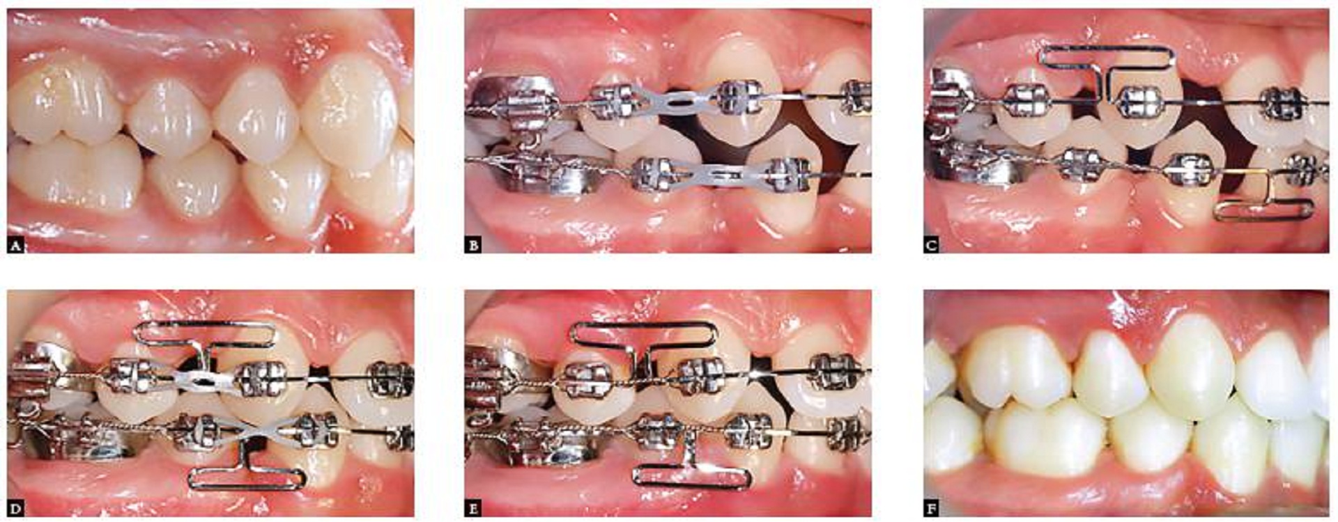 Best dental treatment in vibhuti khand lucknow